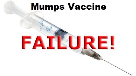 mumps_vaccine_failure