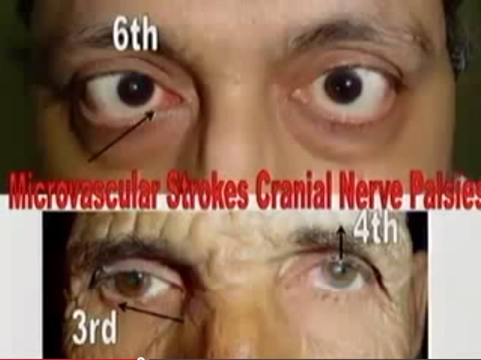 third fourth sixth cranial nerves